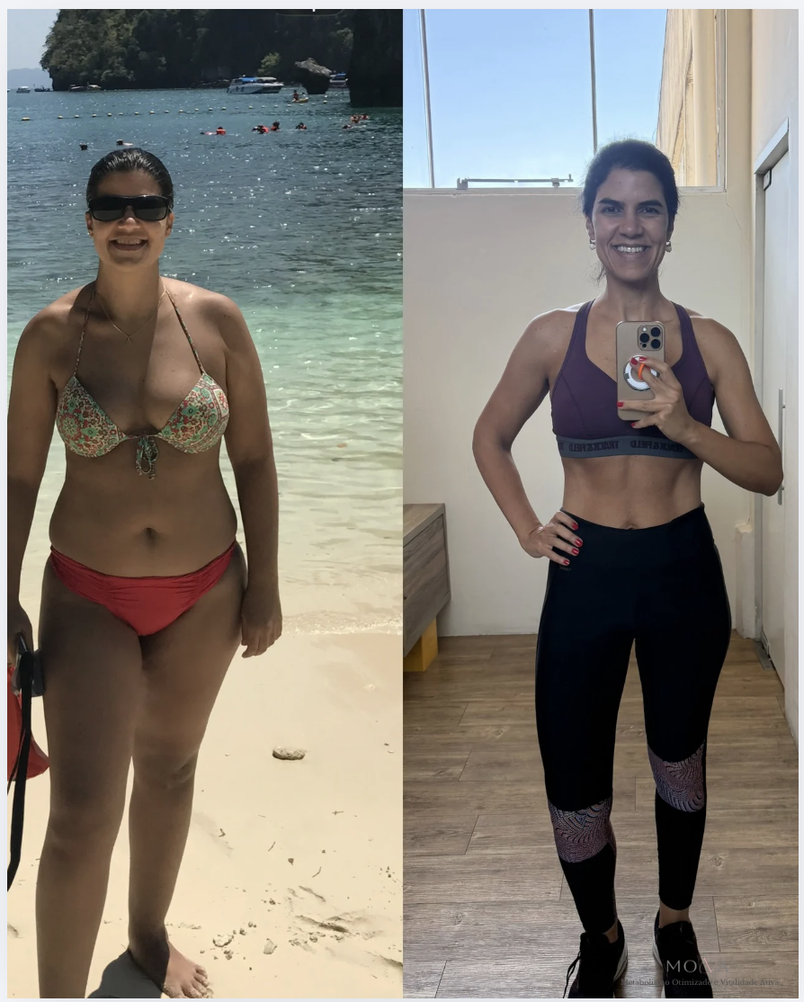 Antes e depois da Dra. Bruna de Deus Lima